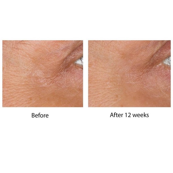 NIB NWT No7 Laboratories Line Correcting Booster Serum - Picture 6 of 15